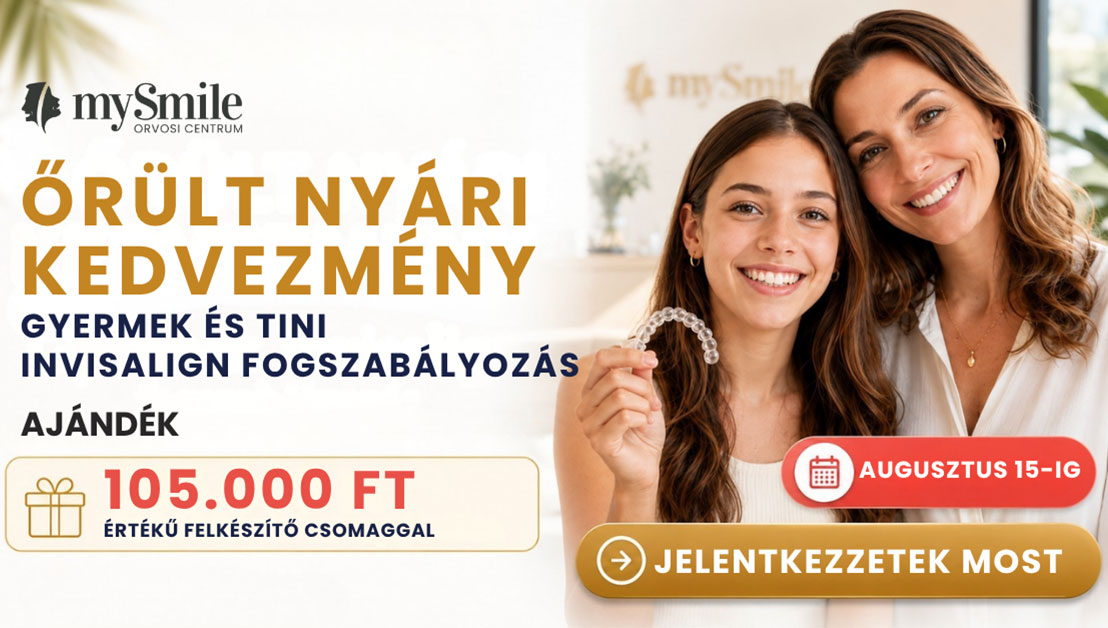 mySmile aktuális ajánlat