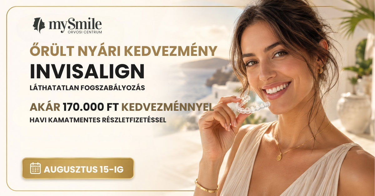 Invisalign nyári akció