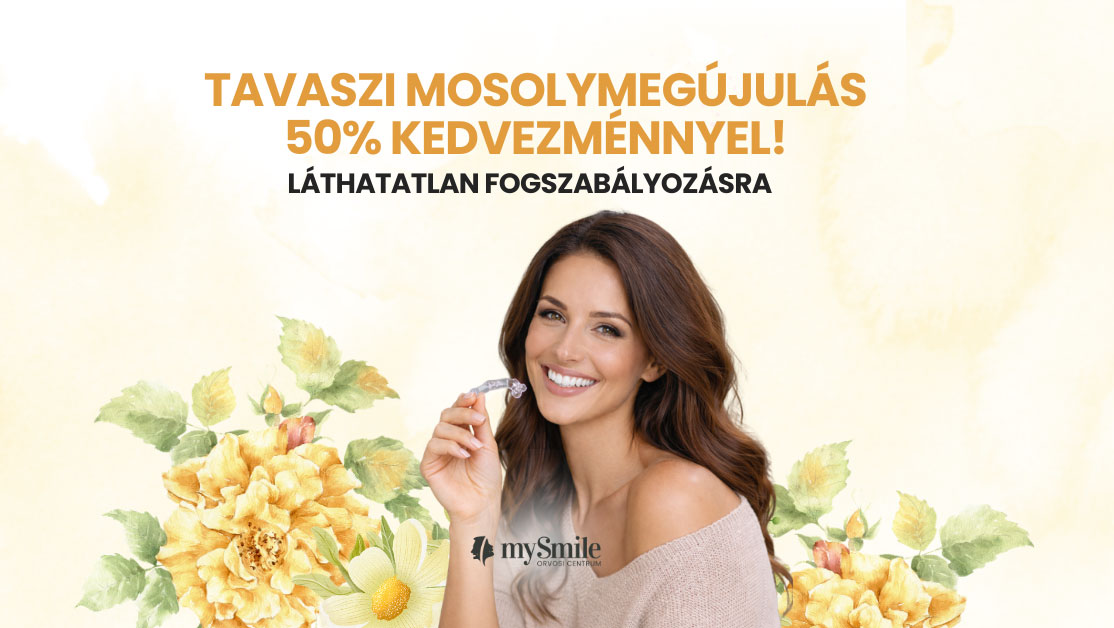 mySmile aktuális ajánlat